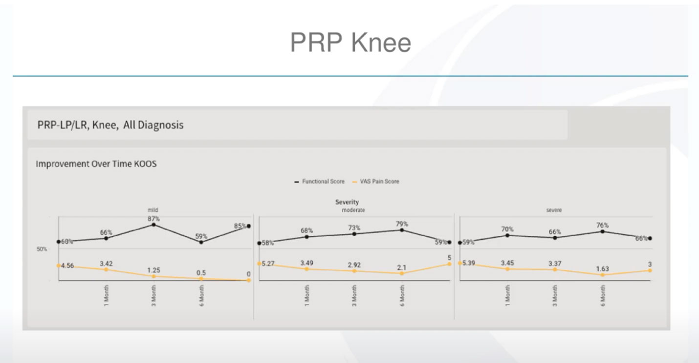 PRP Knee Chart