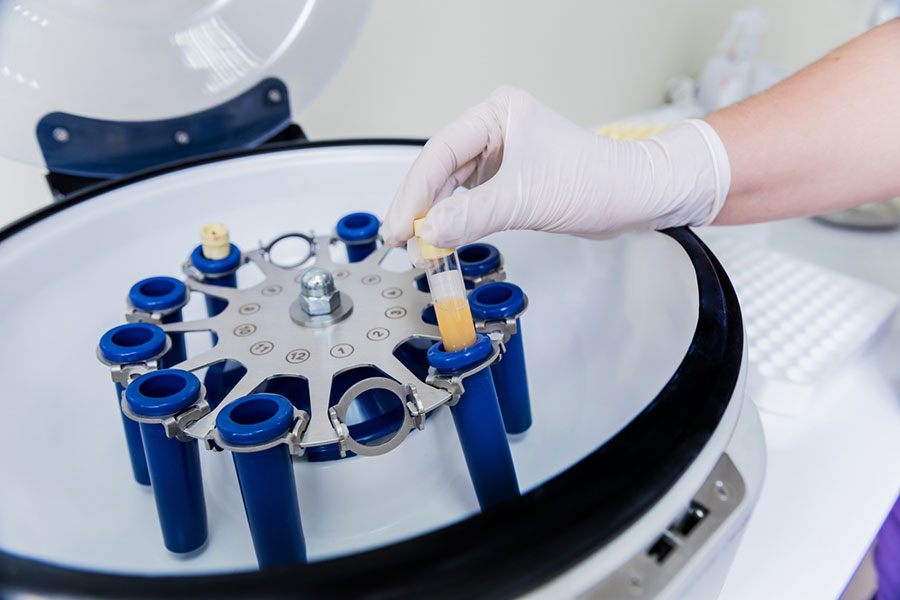 PRP Centrifuge